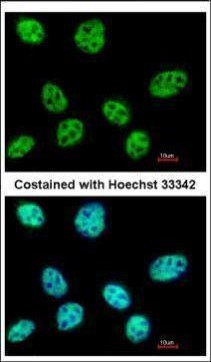 POLR3E Antibody in Immunocytochemistry (ICC/IF)