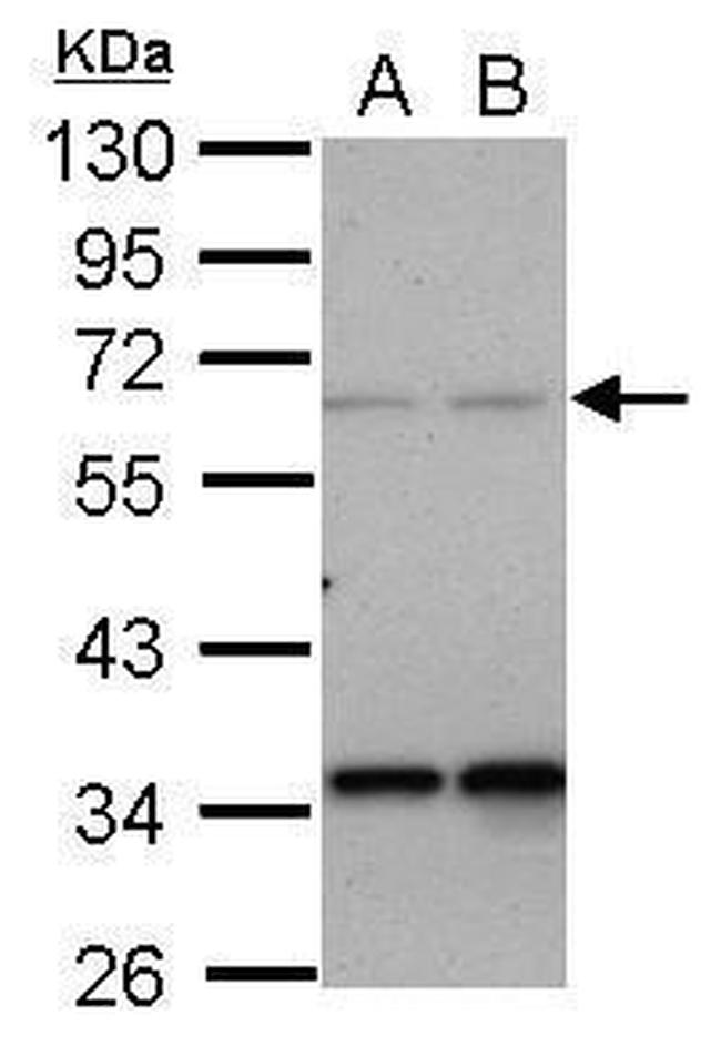 PPP4R2 Antibody in Western Blot (WB)