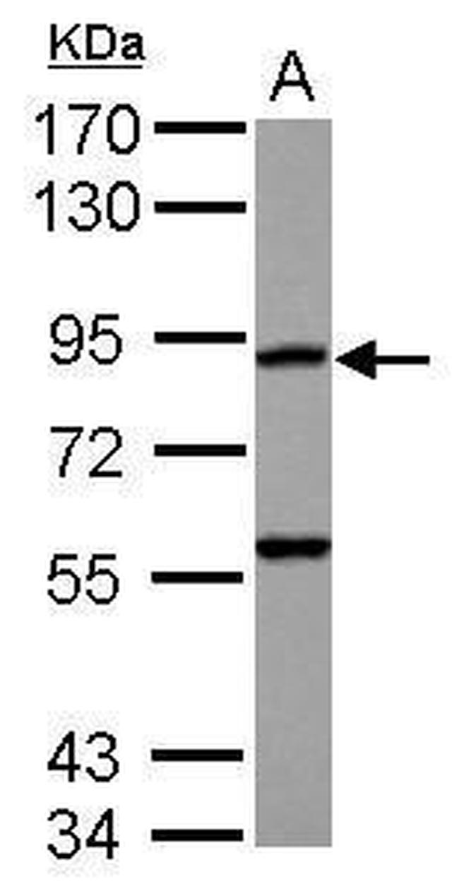 RASA4 Antibody in Western Blot (WB)