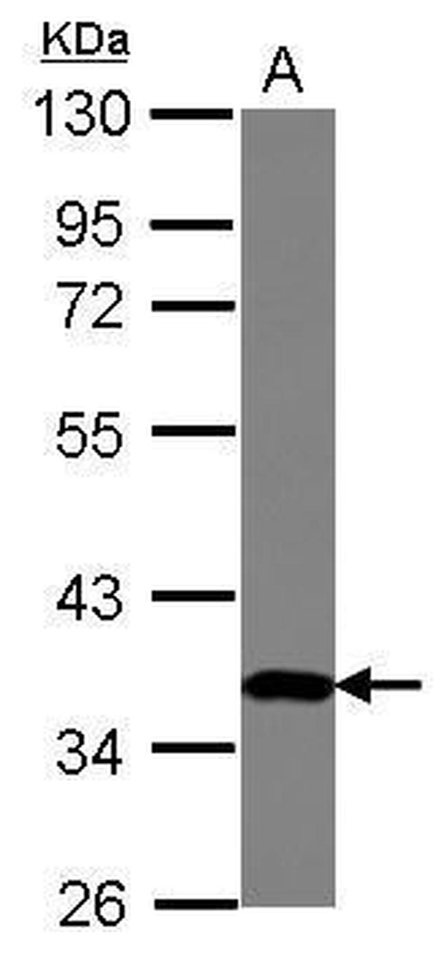 ZNF177 Antibody in Western Blot (WB)