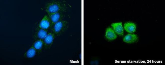 WIPI2 Antibody in Immunocytochemistry (ICC/IF)
