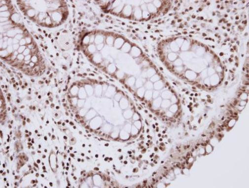 R3HDM2 Antibody in Immunohistochemistry (Paraffin) (IHC (P))
