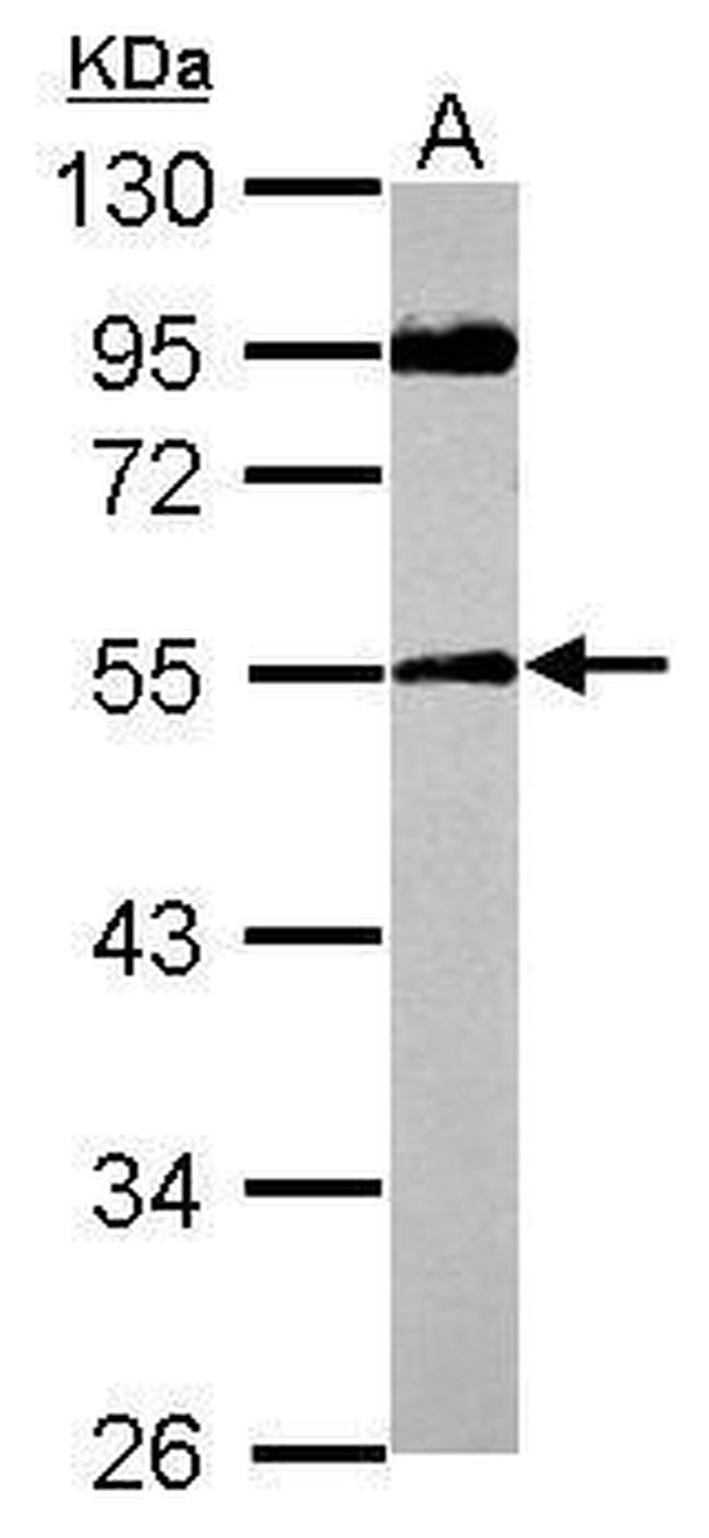 SPAG8 Antibody in Western Blot (WB)