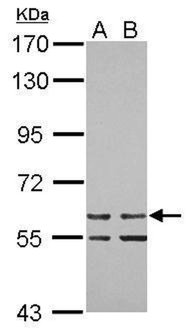 ZNF419 Antibody in Western Blot (WB)