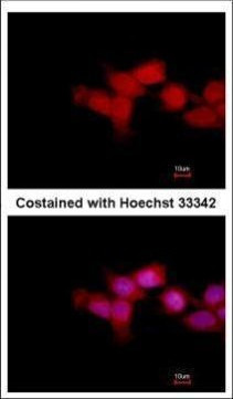 OTUD6B Antibody in Immunocytochemistry (ICC/IF)