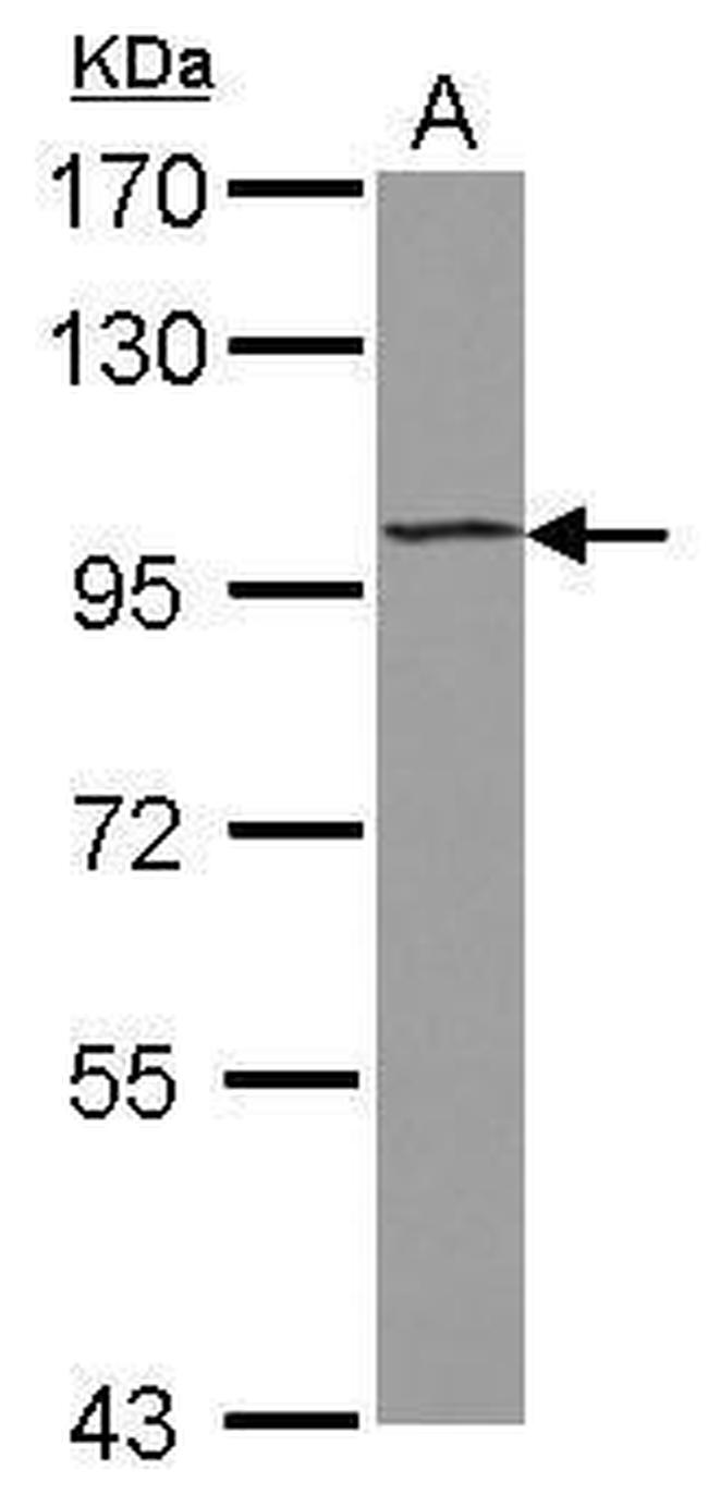 ST18 Antibody in Western Blot (WB)