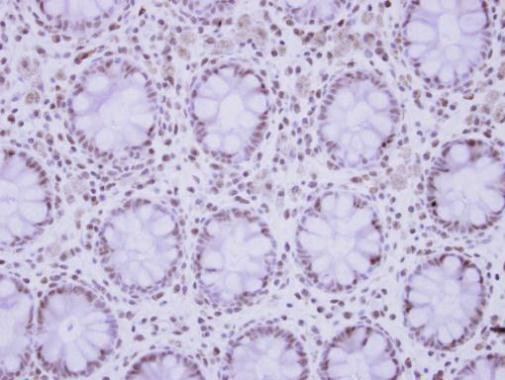 ZNF418 Antibody in Immunohistochemistry (Paraffin) (IHC (P))
