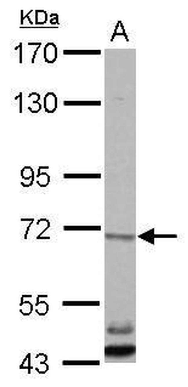 CBLL1 Antibody in Western Blot (WB)