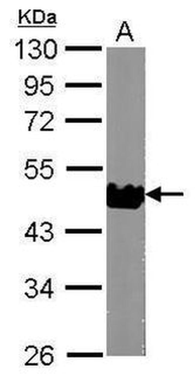 Apelin Receptor Antibody in Western Blot (WB)