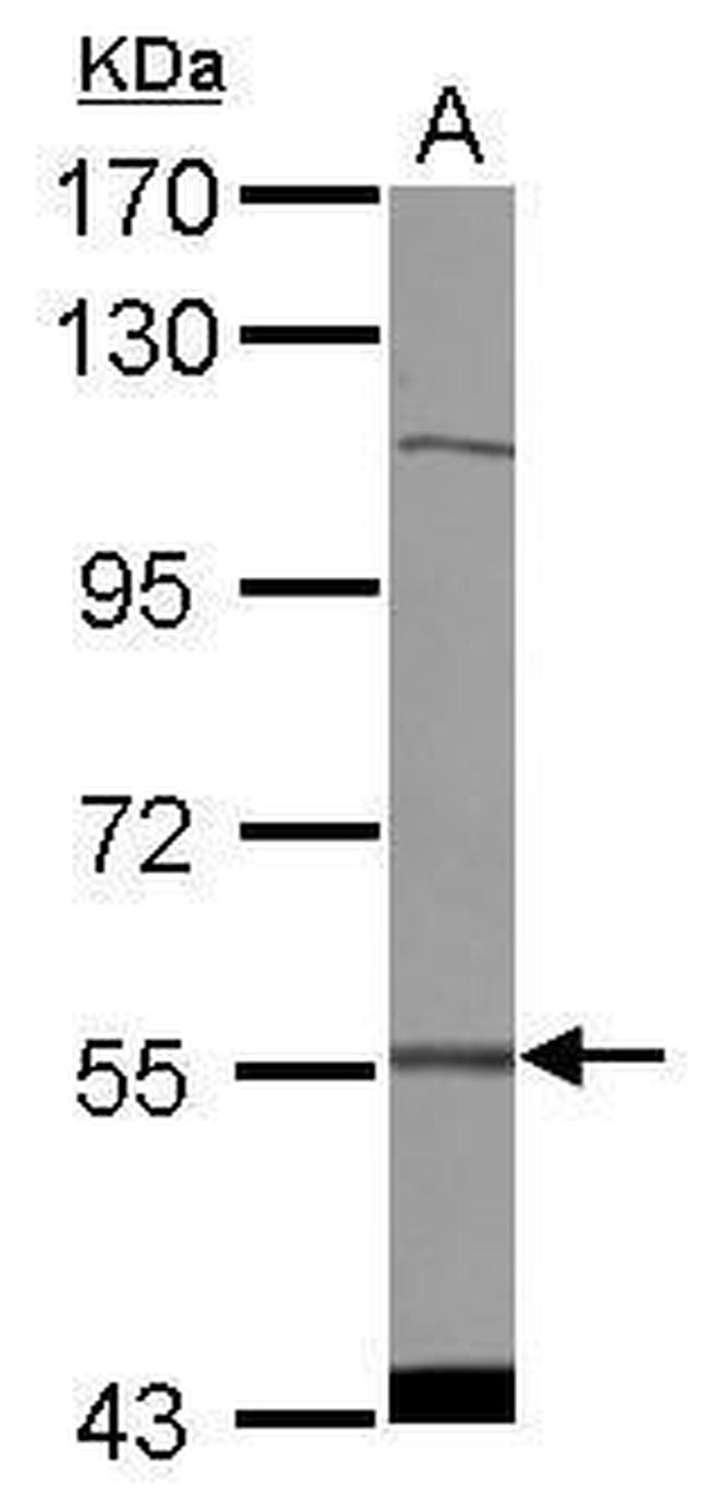 CDADC1 Antibody in Western Blot (WB)