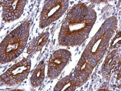CTAGE1 Antibody in Immunohistochemistry (Paraffin) (IHC (P))