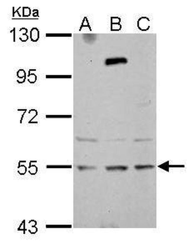 ZNF513 Antibody in Western Blot (WB)
