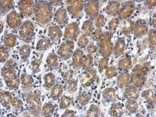 RUNDC1 Antibody in Immunohistochemistry (Paraffin) (IHC (P))