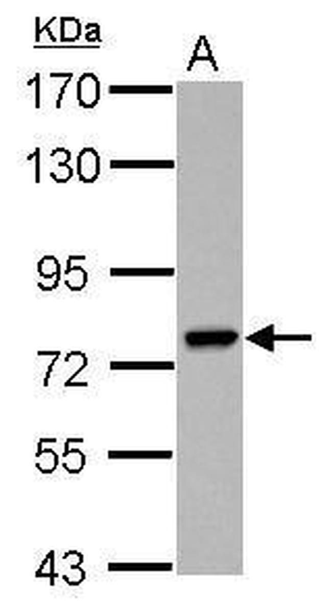 PARP6 Antibody in Western Blot (WB)