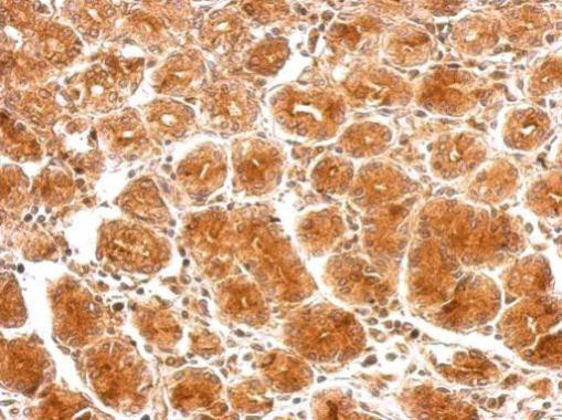 SAMD4B Antibody in Immunohistochemistry (Paraffin) (IHC (P))