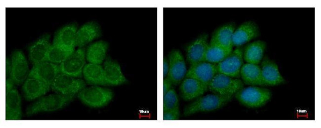 PECI Antibody in Immunocytochemistry (ICC/IF)