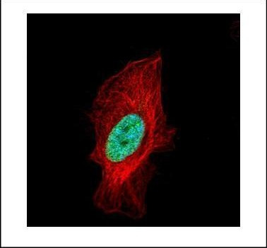 Histone H1.2 Antibody in Immunocytochemistry (ICC/IF)