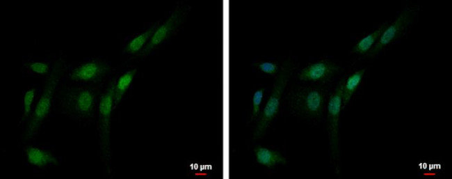 PFKFB3 Antibody in Immunocytochemistry (ICC/IF)