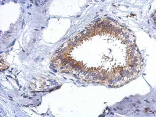 CCDC97 Antibody in Immunohistochemistry (Paraffin) (IHC (P))