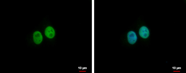 BRMS1L Antibody in Immunocytochemistry (ICC/IF)