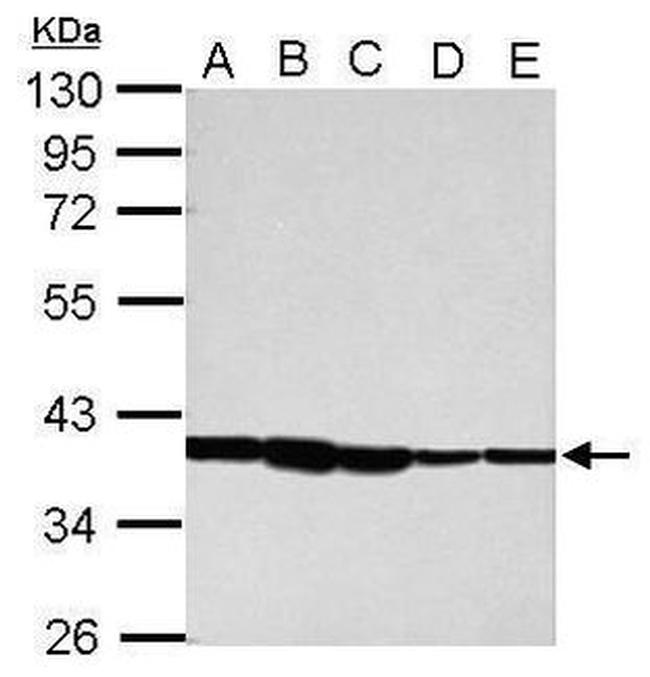 ATXN7L3 Antibody in Western Blot (WB)
