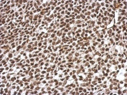 ARID5A Antibody in Immunohistochemistry (Paraffin) (IHC (P))
