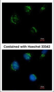 TMEM59L Antibody in Immunocytochemistry (ICC/IF)