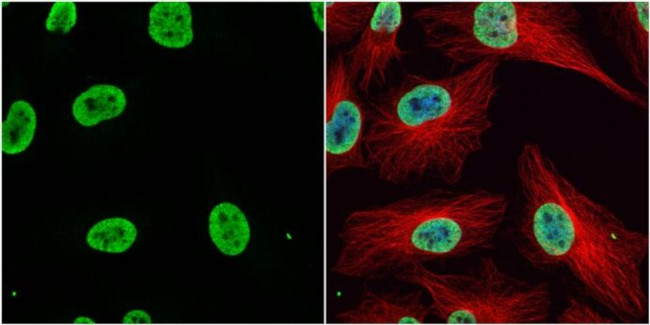 H3K9acK14ac Antibody in Immunocytochemistry (ICC/IF)