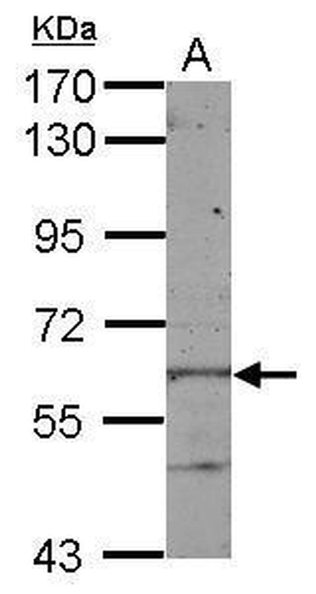 KLHL28 Antibody in Western Blot (WB)
