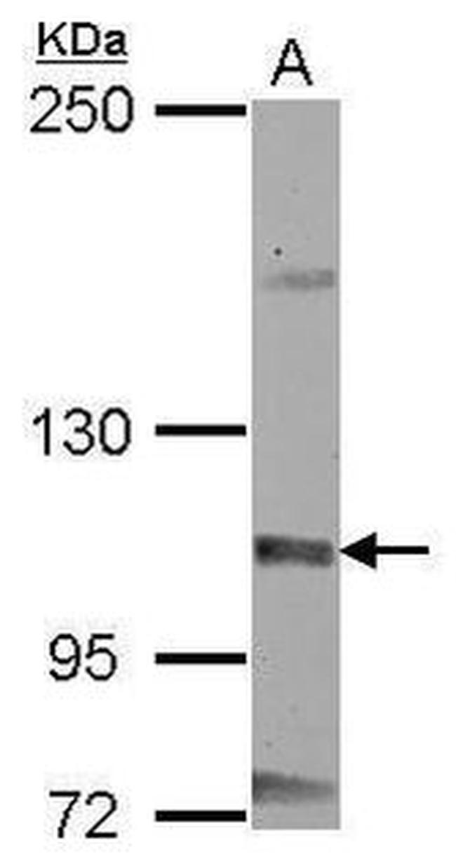 MCM8 Antibody in Western Blot (WB)