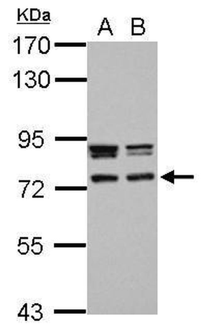 CCDC151 Antibody in Western Blot (WB)