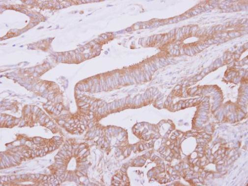THUMPD2 Antibody in Immunohistochemistry (Paraffin) (IHC (P))
