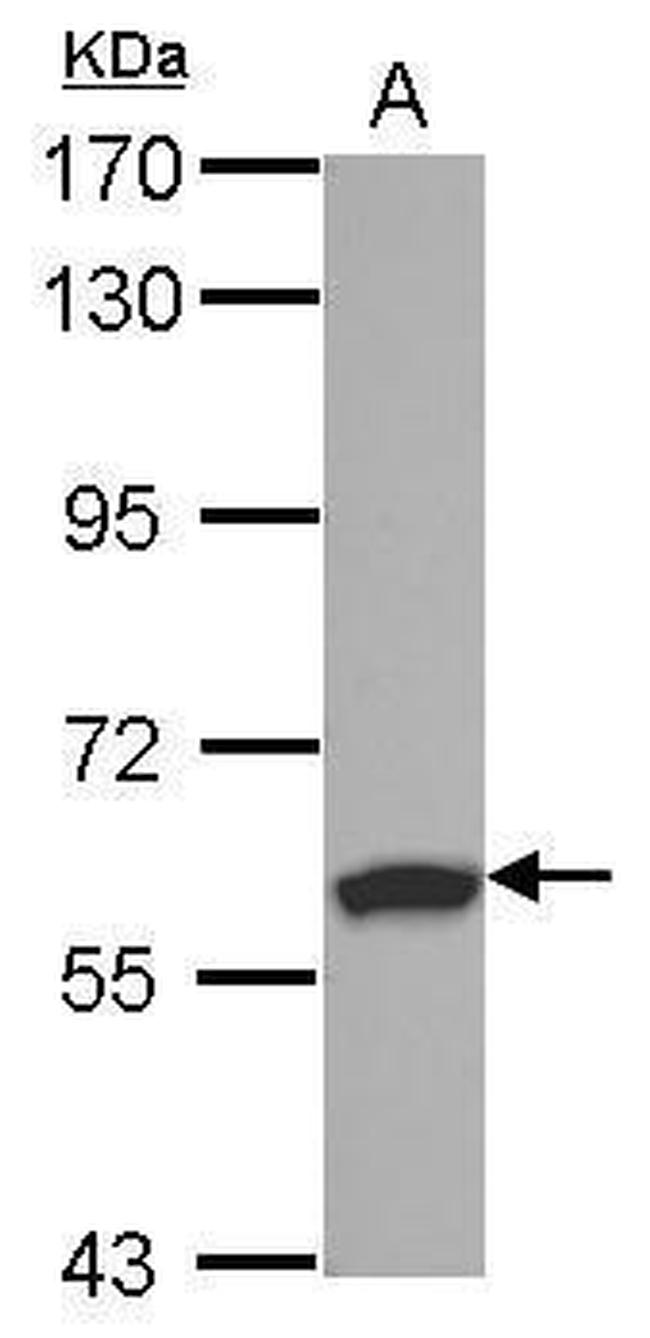 RSPRY1 Antibody in Western Blot (WB)