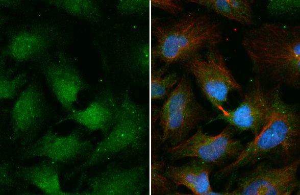 CHMP4C Antibody in Immunocytochemistry (ICC/IF)
