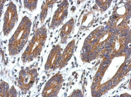 CCDC127 Antibody in Immunohistochemistry (Paraffin) (IHC (P))