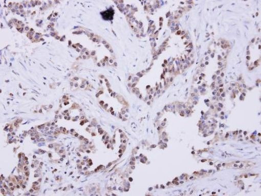 GFM2 Antibody in Immunohistochemistry (IHC)