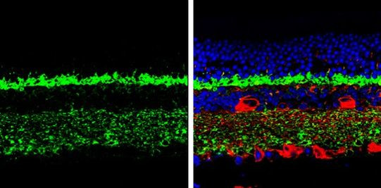 CPLX3 Antibody in Immunohistochemistry (Paraffin) (IHC (P))