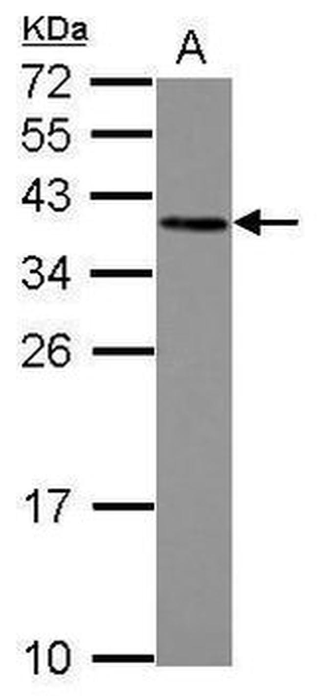 LOX-1 Antibody in Western Blot (WB)
