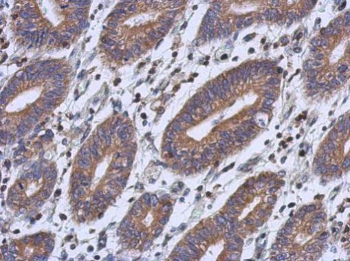 RFESD Antibody in Immunohistochemistry (Paraffin) (IHC (P))