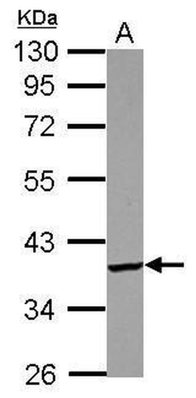 PDIK1L Antibody in Western Blot (WB)