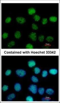 ZNF597 Antibody in Immunocytochemistry (ICC/IF)