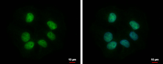 RBMY1F Antibody in Immunocytochemistry (ICC/IF)