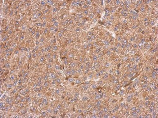 CCDC105 Antibody in Immunohistochemistry (Paraffin) (IHC (P))