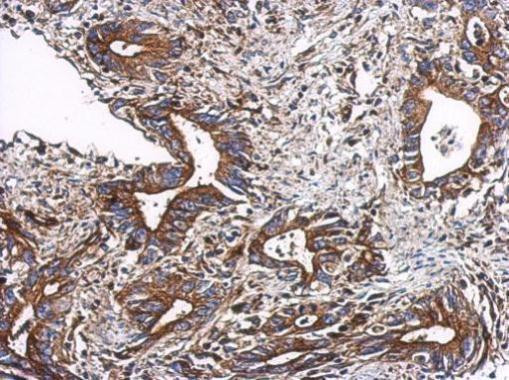 TTC31 Antibody in Immunohistochemistry (Paraffin) (IHC (P))