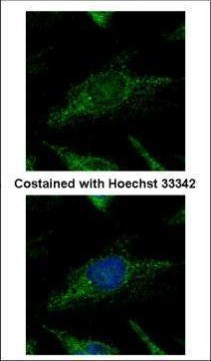 SUPV3L1 Antibody in Immunocytochemistry (ICC/IF)