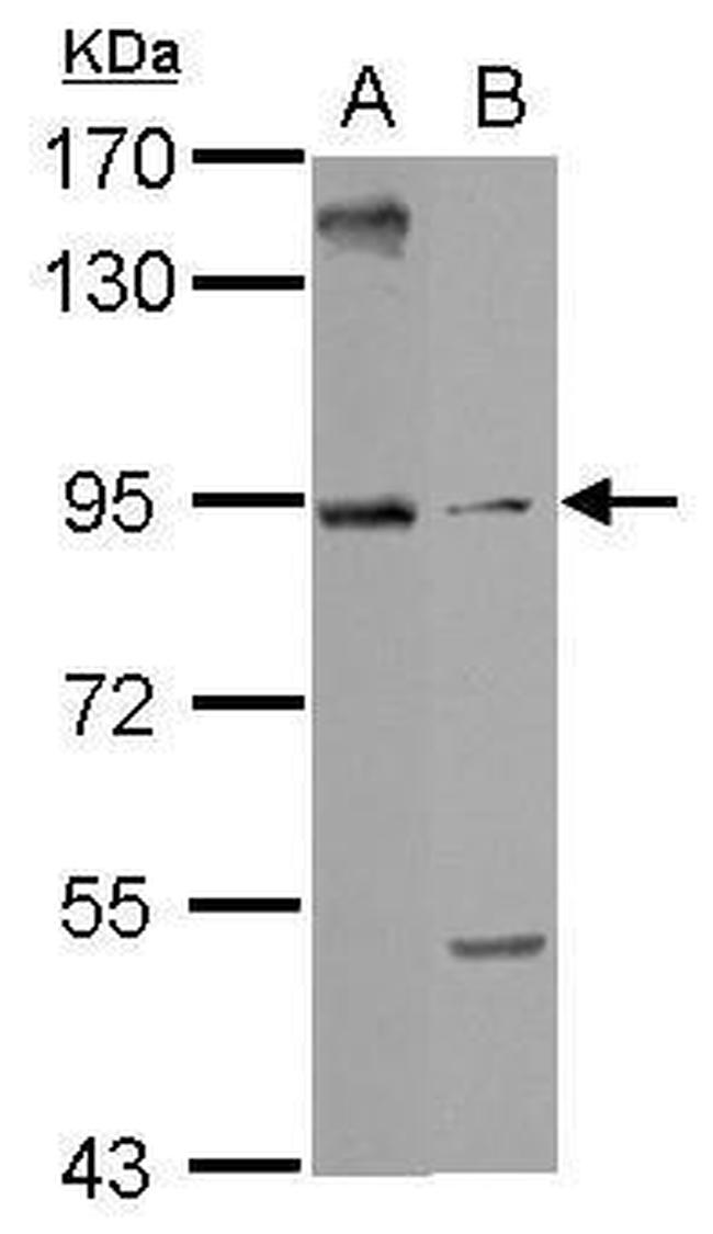 ARMC3 Antibody in Western Blot (WB)