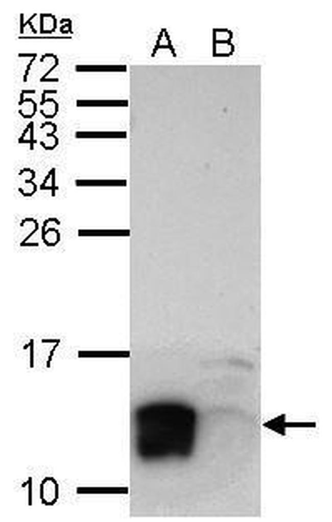 LYPD6 Antibody in Western Blot (WB)