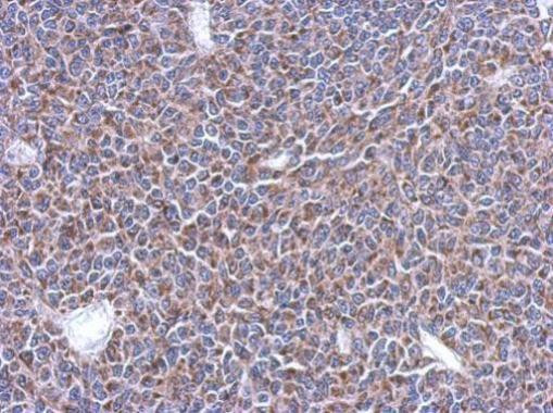 MRPL14 Antibody in Immunohistochemistry (Paraffin) (IHC (P))