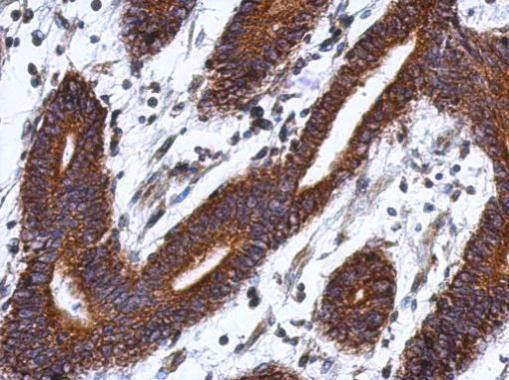LSG1 Antibody in Immunohistochemistry (Paraffin) (IHC (P))