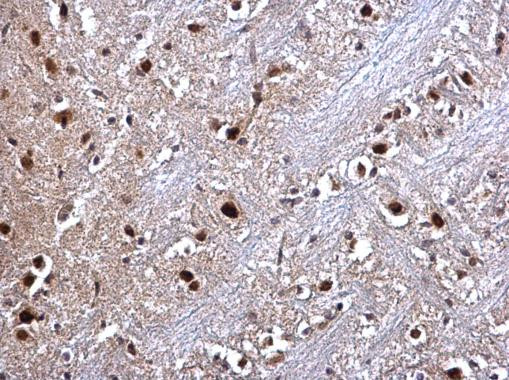 RED Antibody in Immunohistochemistry (Paraffin) (IHC (P))